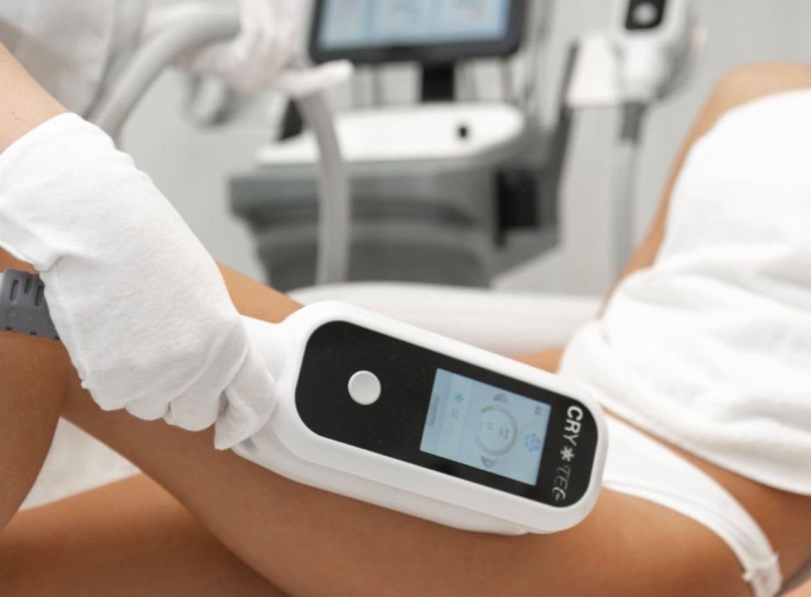 kriolipolizės procedūra